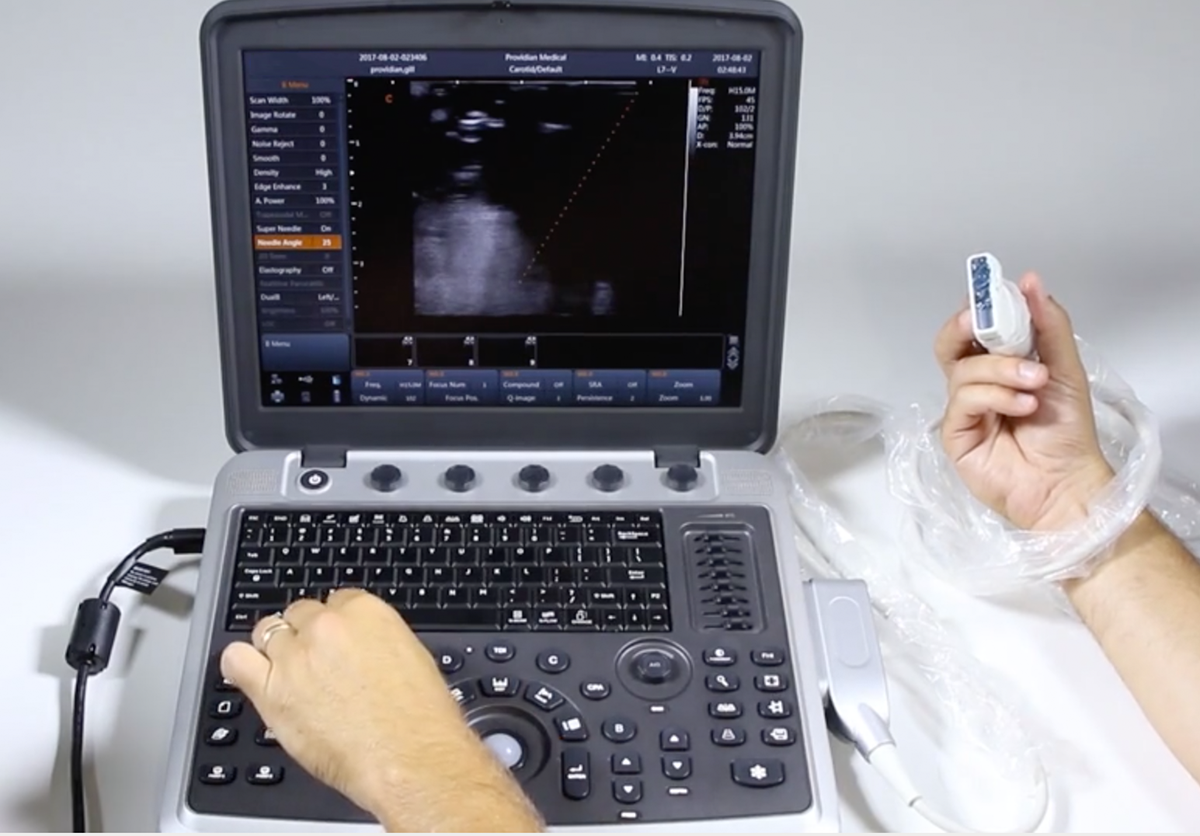 Ultrasound diagnostics. Chison SONOBOOK 9. Chison УЗИ. УЗИ аппарат в педиатрии c Сhison. УЗИ аппарат Чессон.