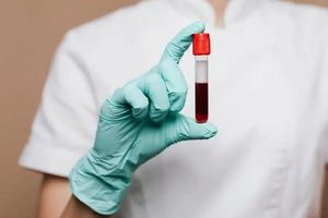 Современные методы диагностики крови: анализ гематологических и биохимических показателей  из