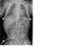 Рентген дигитайзер AGFA DX-M - оцифровщик рентгеновских снимков 4 из 4