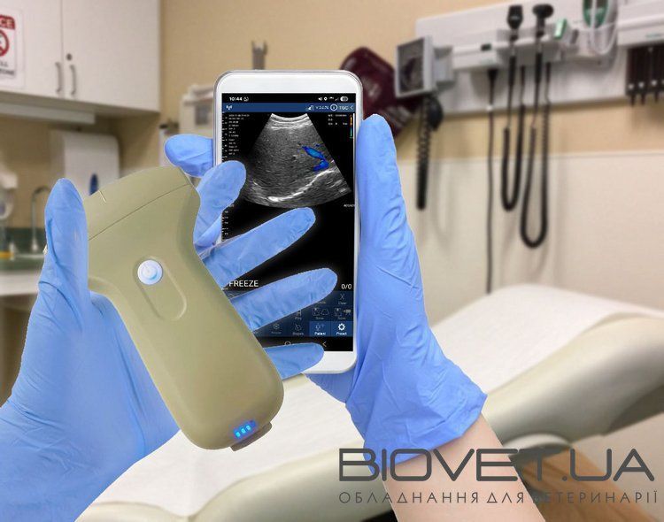 Бездротовий конвексний УЗД-датчик BIOSCAN Probe 3C