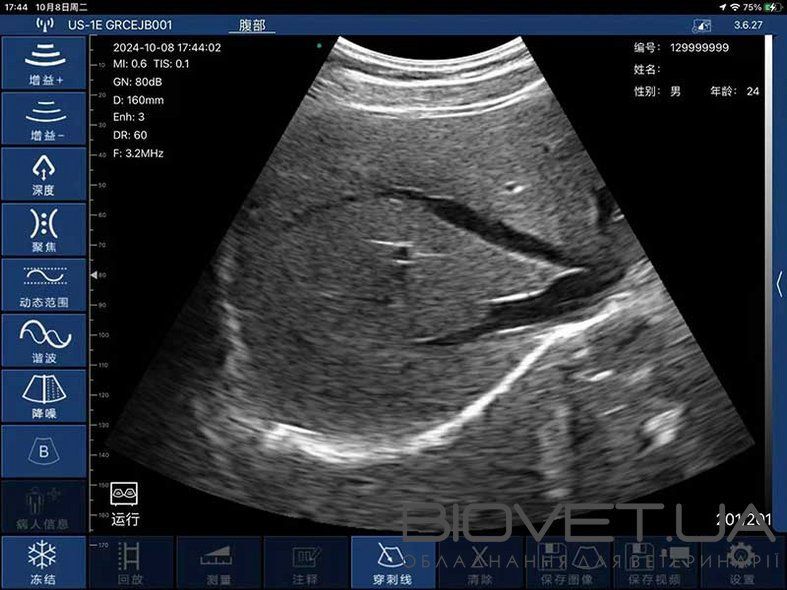 Бездротовий конвексний УЗД-датчик BIOSCAN Probe 3C