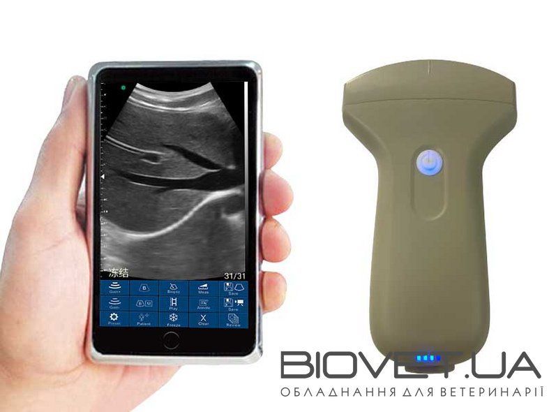 Бездротовий конвексний УЗД-датчик BIOSCAN Probe 3C