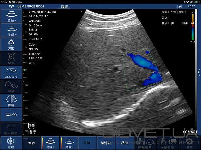 Бездротовий конвексний УЗД-датчик BIOSCAN Probe 3C
