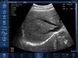 Бездротовий конвексний УЗД-датчик BIOSCAN Probe 3C 4 з 5
