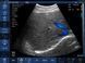 Бездротовий конвексний УЗД-датчик BIOSCAN Probe 3C 5 з 5