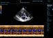 Vetus 8 УЗД-сканер для ветеринарії з кольоровим доплером, Mindray 10 з 17