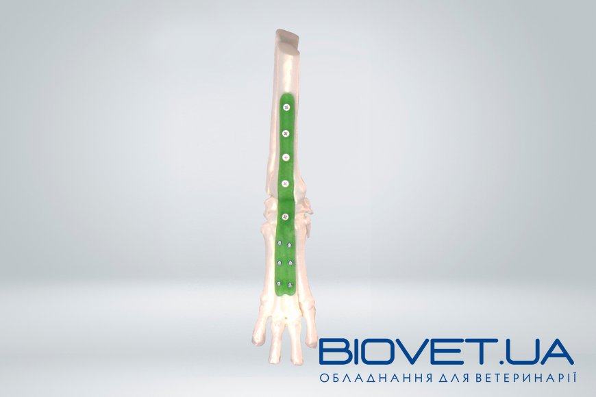 Изготовление индивидуальных пластин и имплантов под артродезирование суставов.