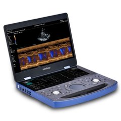 Портативний УЗД-сканер із кольоровим доплером Vetus E7 Basic, Mindray