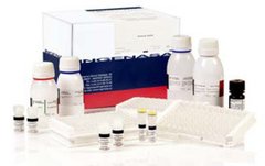 Ingezim PPA Das. Тест-система для диагностики специфического антигена вируса АЧС