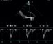 Ультразвуковой ветеринарный сканер MyLab AlphaVET 11 из 12