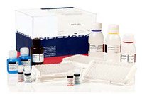 Тест-система для серодіагн. спец. антитіл до Lentovirus в сироватці крові методом ІФА (непрямий варіант)