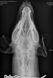 Рентген дигітайзер FireCR flash - оцифровщик рентгенівських знімків 4 з 7