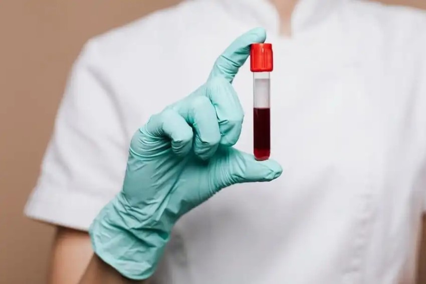 Современные методы диагностики крови: анализ гематологических и биохимических показателей