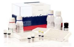 Ingezim BLV Compac 2.0. Тест-система для діагностики специфічних антитіл до вірусу лейкозу ВРХ